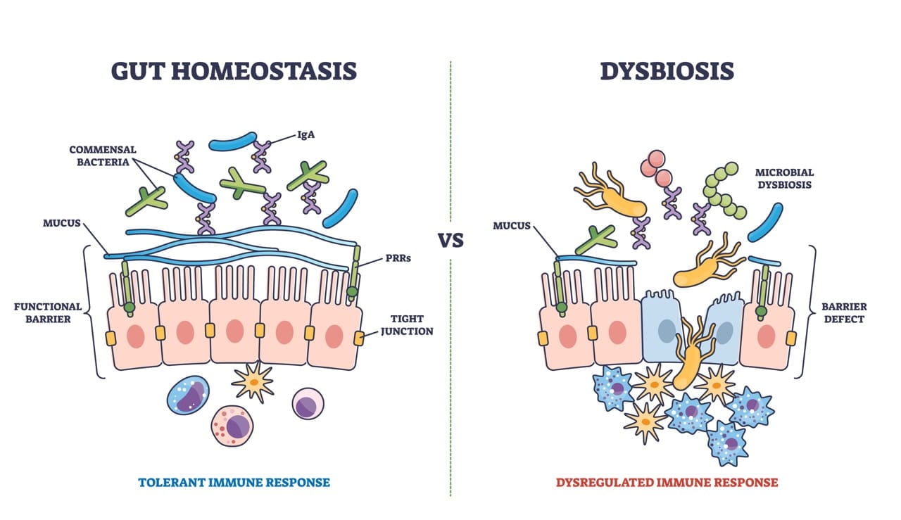 Gut Homeostasis vs Dysbiosis graphic